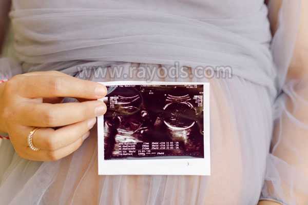 香港验血胎停又怀孕,要二胎的家庭必看,高龄女性们的试管指南
